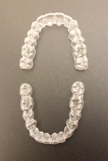 iGOシステムの特徴1